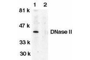 Western blot analysis of DNase II in human spleen tissue lysate in the absence (lane 1) or presence (lane 2) of blocking peptide with DNase II antibody at 1μg/ml. (DNASE2 anticorps)