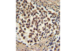 Immunohistochemistry (IHC) image for anti-SNAI antibody (ABIN2912021) (SNAI anticorps)