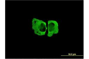 Immunofluorescence of monoclonal antibody to MSRA on HeLa cell. (MSRA anticorps  (AA 1-100))