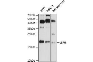 Western blot analysis of extracts of various cell lines, using LLPH antibody (ABIN7268289) at 1:1000 dilution. (LLPH anticorps  (AA 1-129))