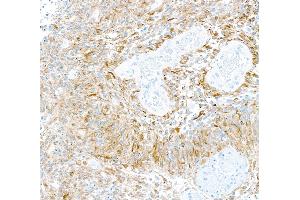 Immunohistochemistry (IHC) image for anti-Tubulin, beta 3 (TUBB3) (AA 400-450) antibody (ABIN7453957) (Recombinant TUBB3 anticorps  (AA 400-450))