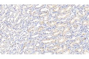 Detection of IL18 in Rabbit Kidney Tissue using Polyclonal Antibody to Interleukin 18 (IL18) (IL-18 anticorps  (AA 32-192))
