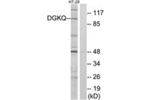 Western blot analysis of extracts from HT-29 cells, using DGKQ Antibody. (DGKQ anticorps  (AA 691-740))