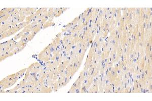 Detection of MAP1B in Mouse Cardiac Muscle Tissue using Polyclonal Antibody to Microtubule Associated Protein 1B (MAP1B)
