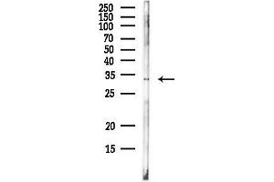 anti-POU Class 1 Homeobox 1 (POU1F1) antibody