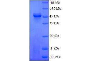 SDS-PAGE (SDS) image for Fibrinogen-Like 2 (FGL2) (AA 24-439) protein (His tag) (ABIN5714332)