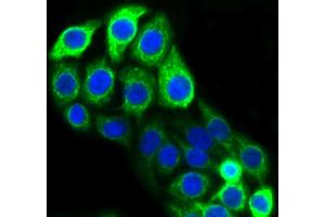 CRC cells were fixed in paraformaldehyde, permeabilized with 0.