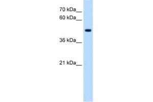 Western Blotting (WB) image for anti-serine/threonine/tyrosine Kinase 1 (STYK1) antibody (ABIN2463064) (STYK1 anticorps)