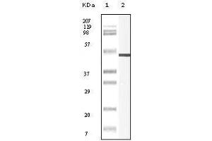 Western blot analysis using Vimentin mouse mAb against truncated Vimentin recombinant protein.