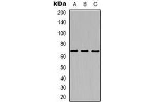 Western blot analysis of MT-ND5 expression in K562 (A), Hela (B), mouse kidney (C) whole cell lysates.