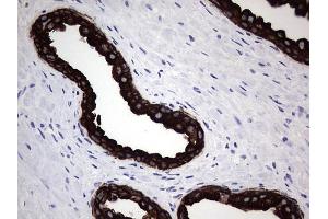 Immunohistochemistry (IHC) image for anti-Keratin Acidic (AE1) antibody (ABIN2715666)