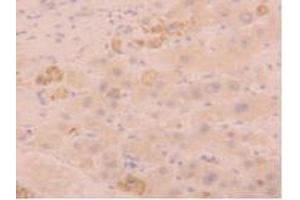IHC-P analysis of Human Liver Tissue, with DAB staining. (FGL1 anticorps  (AA 23-312))