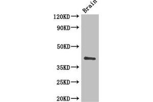 Western Blot Positive WB detected in: Mouse brain tissue All lanes: CD34 antibody at 3 μg/mL Secondary Goat polyclonal to rabbit IgG at 1/50000 dilution Predicted band size: 41, 36 kDa Observed band size: 41 kDa