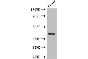 Western Blot Positive WB detected in: Mouse brain tissue All lanes: CD34 antibody at 3 μg/mL Secondary Goat polyclonal to rabbit IgG at 1/50000 dilution Predicted band size: 41, 36 kDa Observed band size: 41 kDa (CD34 anticorps  (AA 124-375))