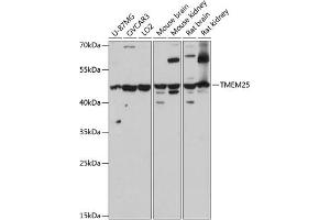 Western blot analysis of extracts of various cell lines, using TMEM25 antibody (ABIN7270963) at 1:3000 dilution. (TMEM25 anticorps  (AA 223-322))