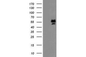 Image no. 1 for anti-Protein Arginine Methyltransferase 2 (PRMT2) antibody (ABIN1500418) (PRMT2 anticorps)