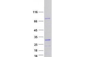 Validation with Western Blot