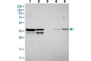 Western blot analysis of Lane 1: RT-4, Lane 2: U-251 MG, Lane 3: Human Plasma, Lane 4: Liver, Lane 5: Tonsil with SNRNP40 polyclonal antibody  at 1:250-1:500 dilution. (SNRNP40 anticorps)