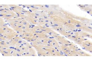 Detection of IkBb in Mouse Cardiac Muscle Tissue using Polyclonal Antibody to Inhibitory Subunit Of NF Kappa B Beta (IkBb)