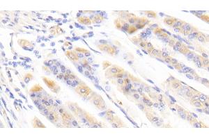 Detection of BFP in Mouse Stomach Tissue using Polyclonal Antibody to Brain Finger Protein (BFP)