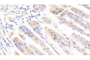 Detection of BFP in Mouse Stomach Tissue using Polyclonal Antibody to Brain Finger Protein (BFP) (RNF112 anticorps  (AA 403-647))