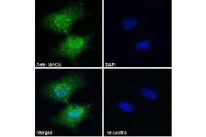 ABIN185506 Immunofluorescence analysis of paraformaldehyde fixed HeLa cells, permeabilized with 0.