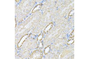 Immunohistochemistry of paraffin-embedded mouse kidney using Alpha Fodrin antibody (ABIN6128747, ABIN6148403, ABIN6148404 and ABIN6213643) at dilution of 1:100 (40x lens).