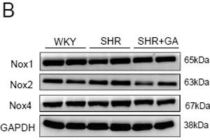 GA attenuates Nox2 expression in SHRs and angiotensin II-treated H9c2 cells.