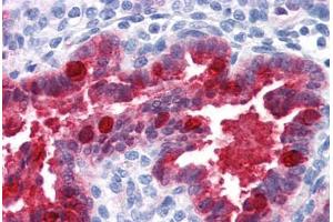 Human Uterus (formalin-fixed, paraffin-embedded) stained with NQO1 antibody ABIN364280 at 1:100 followed by biotinylated anti-mouse IgG secondary antibody ABIN481714, alkaline phosphatase-streptavidin and chromogen. (NQO1 anticorps)