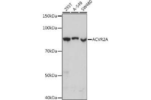 Western blot analysis of extracts of various cell lines, using A Rabbit mAb  at 1:1000 dilution.