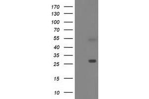Western Blotting (WB) image for anti-Sepiapterin Reductase (SPR) antibody (ABIN1501112) (SPR anticorps)