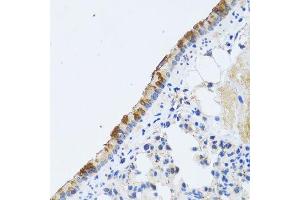 Immunohistochemistry of paraffin-embedded rat lung using ST3GAL3 antibody.
