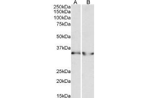 ABIN4902694 (0. (LDHB anticorps)