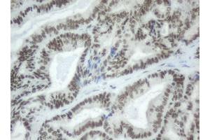 Image no. 2 for anti-Splicing Factor 3a, Subunit 1 (SF3A1) (AA 249-568) antibody (ABIN1491272)