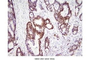Immunohistochemistry (IHC) image for anti-High Mobility Group Box 1 (HMGB1) (AA 1-215), (N-Term) antibody (ABIN356226) (HMGB1 anticorps  (N-Term))