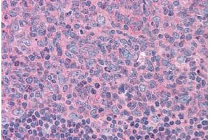 Human Tonsil: Formalin-Fixed, Paraffin-Embedded (FFPE) (ELP3/KAT9 anticorps  (AA 240-445))