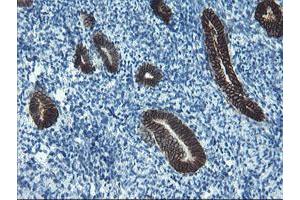 Image no. 3 for anti-Signal Recognition Particle Receptor, B Subunit (SRPRB) antibody (ABIN1501126)