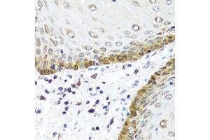 Immunohistochemistry of paraffin-embedded human esophagus using BMP5 antibody.