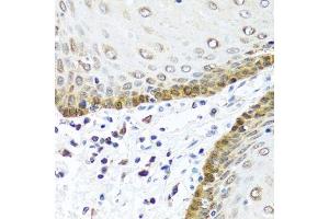 Immunohistochemistry of paraffin-embedded human esophagus using BMP5 antibody. (BMP5 anticorps  (AA 317-454))