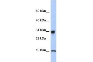 WB Suggested Anti-RPS21 Antibody Titration: 0. (RPS21 anticorps  (N-Term))