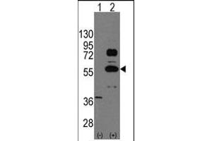 Western blot analysis of SOX9 (arrow) using rabbit polyclonal SOX9 Antibody (N-term) (ABIN388162 and ABIN2846958).