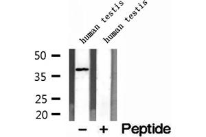 Western blot analysis of extracts of human testis tissue, using DNAJB14 antibody. (DNAJB14 anticorps  (C-Term))