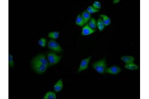 Immunofluorescence staining of Hela cells with ABIN7159221 at 1:133, counter-stained with DAPI.