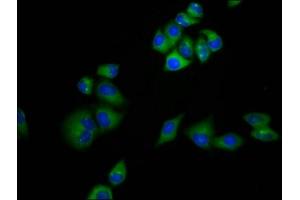 Immunofluorescence staining of Hela cells with ABIN7159221 at 1:133, counter-stained with DAPI. (MRAP anticorps  (AA 59-172))