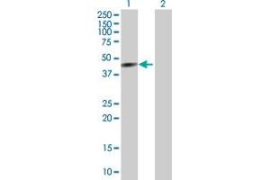 Western Blot analysis of CYP26A1 expression in transfected 293T cell line by CYP26A1 MaxPab polyclonal antibody.