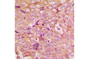 Immunohistochemistry (IHC) image for anti-PDZ and LIM Domain 5 (PDLIM5) antibody (ABIN7308152)