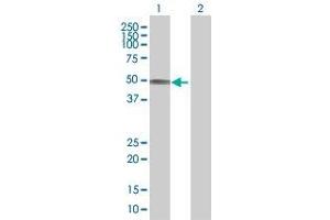 Lane 1: SLC16A1 transfected lysate ( 55.