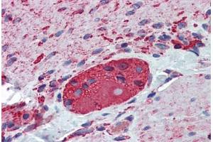 Human Small Intestine, Myenteric Plexus: Formalin-Fixed, Paraffin-Embedded (FFPE) (TUBB2A anticorps  (AA 1-446))