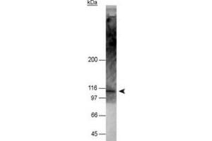 Western blot analysis of NOD2 in 50 ug of HT-29 cell lysate with NOD2 monoclonal antibody, clone 2D9 . (NOD2 anticorps  (AA 28-301))