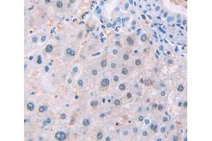 Used in DAB staining on fromalin fixed paraffin- embedded Kidney tissue (NSMAF anticorps  (AA 176-575))